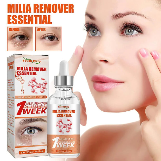 Smooth Milia Remover Serum (30ml)